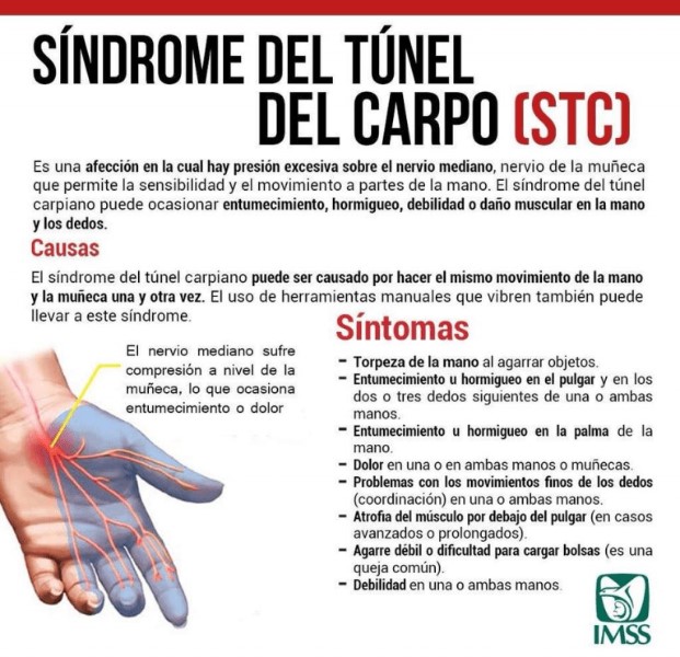 baja-por-tunel-carpiano-seguridad-social