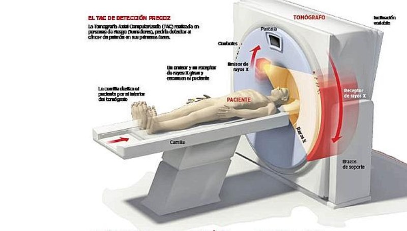 cuanto-dura-la-radiacion-de-un-tac-en-el-cuerpo