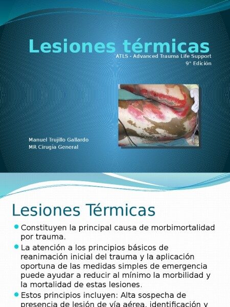 lesion-termica