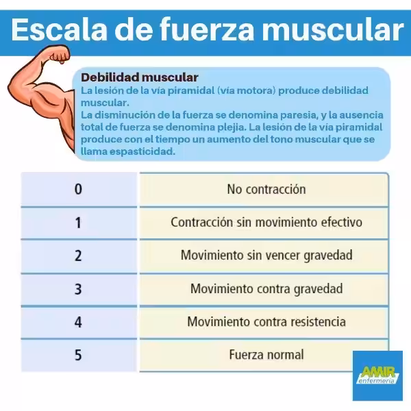 Entendiendo la Fuerza Muscular: Una Guía Completa con la Escala MRC